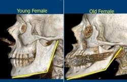 Envelhecimento facial  mais profundo do que uma pele flcida