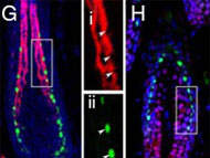 Gene que causa queda de pelos em camundongos pode dar pistas sobre calvcie humana