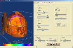 Software livre brasileiro faz planejamento de cirurgia em 3D