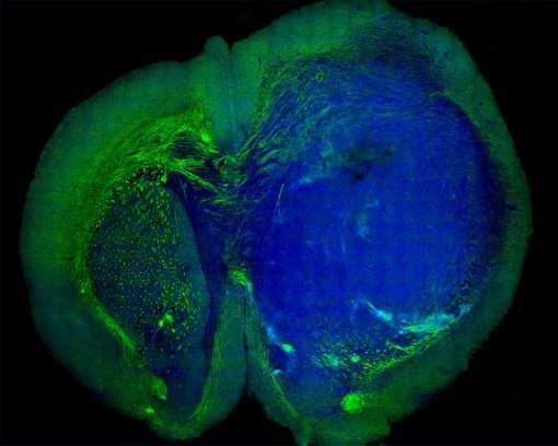 Imagem gerada a laser separa tecido saudvel de tumor