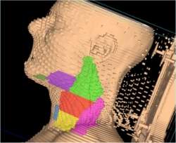 Protocolo reduz efeitos colaterais da radioterapia