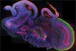 Cientistas criam minicrebros em laboratrio