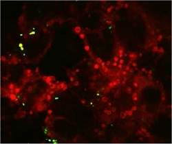 Nanopartculas e grafeno oferecem riscos  sade