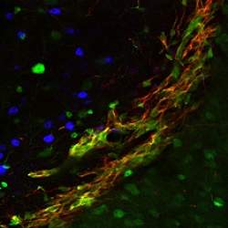 Cientistas conseguem gerar neurnios totalmente funcionais