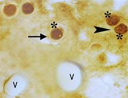 Envelhecer no causa perda de neurnios