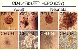 Cientistas transformam pele em sangue