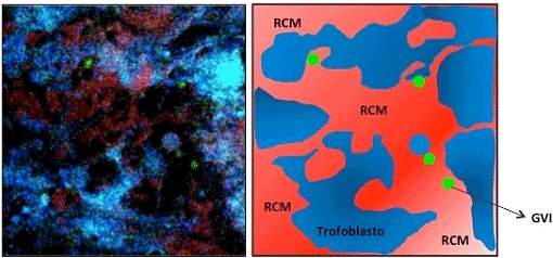 Fluxo sanguneo da placenta influencia malria na gravidez