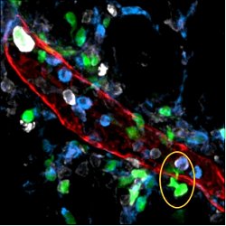 Infeco intestinal pode predispor a doenas metablicas