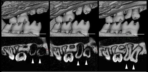 Dentes naturais so multiplicados pela primeira vez