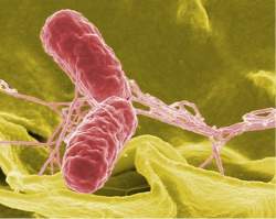 HIV pode ter gerado <i>Salmonella</i> mortal