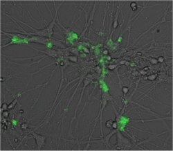 Vrus da herpes podem infectar neurnios